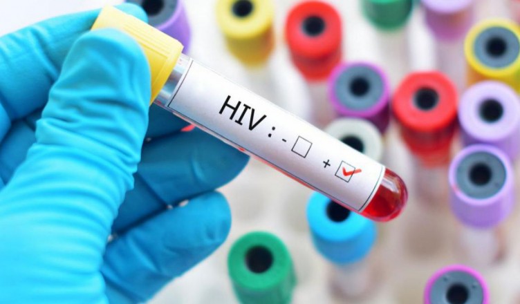unicef-avertizeaza-cazurilor-de-hiv-sida-sunt-in-crestere--in-special-in-randul-adolescentelor-47992