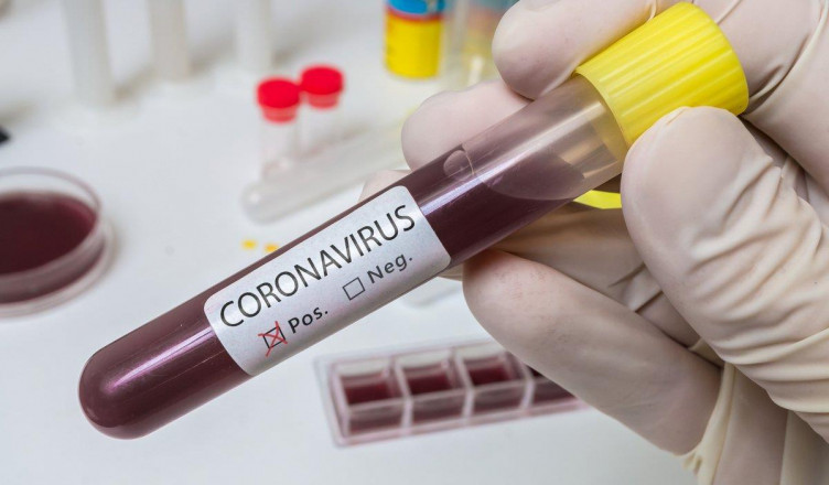 koronavirus-2