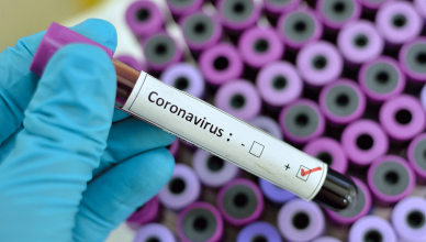 Coronavirus-test-tube