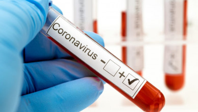 coronavirus-testing-everlywell