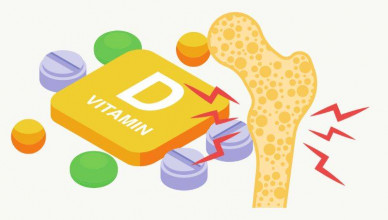 000 Carenţa de vitamina D
