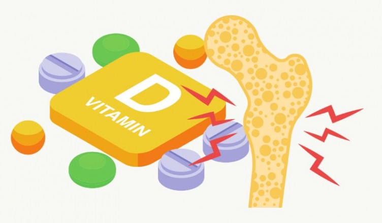 00 Acum 1 A Vitamina D